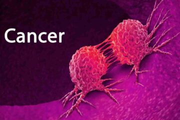 Breast Cancer Metastasis - How Does it Work? 52