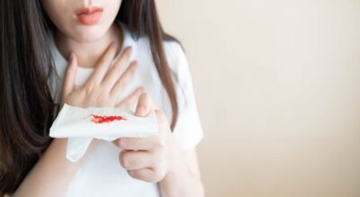 Lung Cancer Coughing Up Blood 49