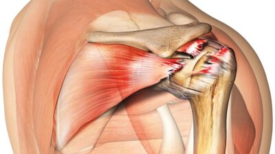 Rotator Cuff Injury Exercise Video 59
